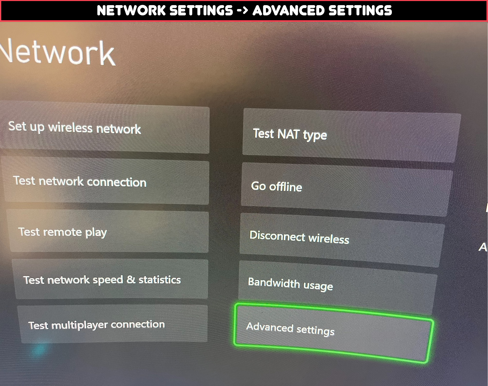 Xbox Advanced Network Settings